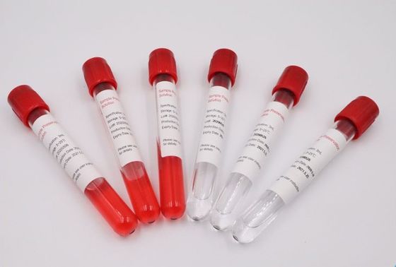 Resistência ultra de alto impacto médica dos tubos do espécime do sangue do ABS
