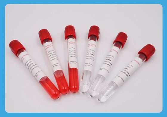 óxido de etileno especial do tubo da coleção da amostra da linha 5ml